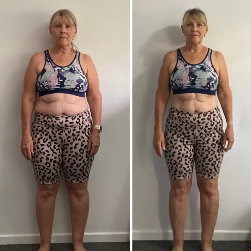 Mandy Inwood transformation